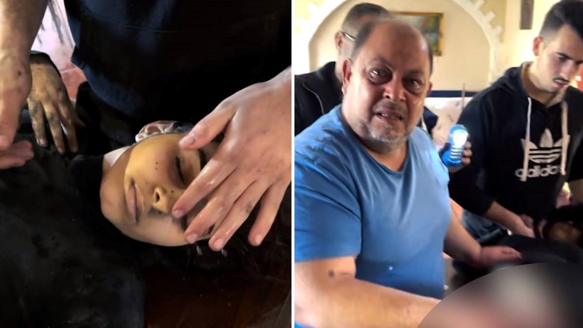 Djevojci iz Gaze amputirali nogu na kuhinjskom stolu običnim nožem. Bez anestezije