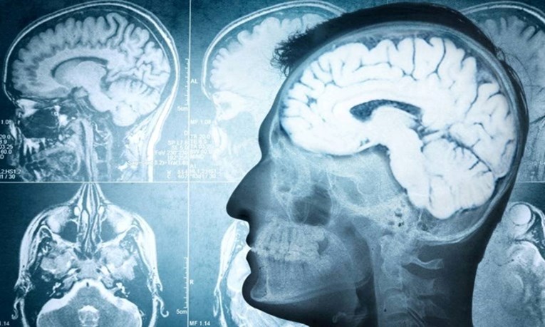 Znanstvenici: Mozak čini nešto čudno, nadzire naše salo i šalje poruke tijelu