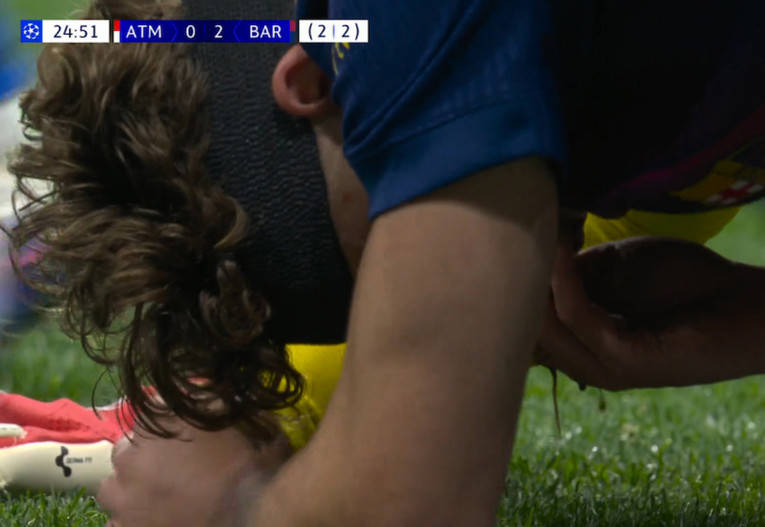 VIDEO Krv je lijevala nakon što je igrač Barce naletio na kopačku Atleticovog golmana