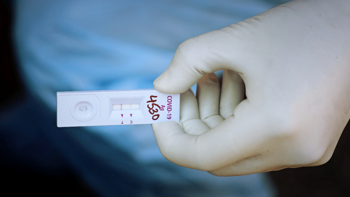 Znanstvenici s Oxforda razvili petominutni test za protutijela na covid-19