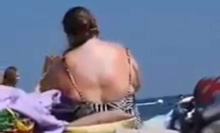 Snimali ženu kako si maže leđa na plaži, postala hit zbog pomagala koje je koristila