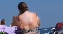 Snimali ženu kako si maže leđa na plaži, postala hit zbog pomagala koje je koristila