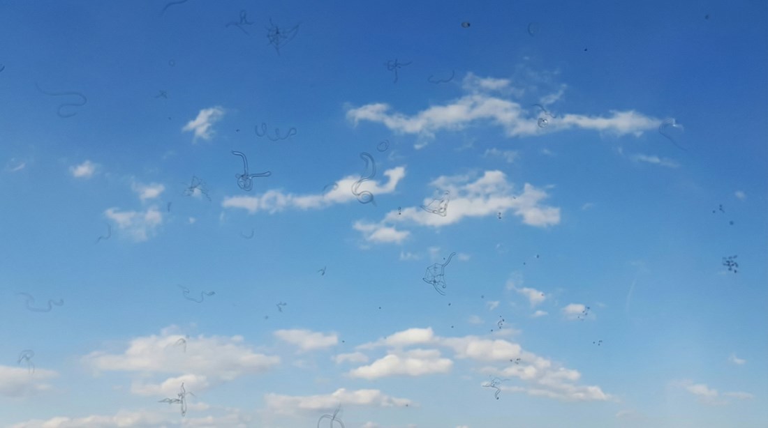 "Mušice" u oku mogle bi biti znak ozbiljnog problema, otkriva nova studija