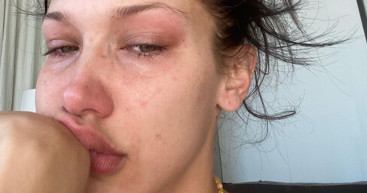 Bella Hadid iznenadila fanove objavom: "Nekoliko godina svakodnevno plačem"
