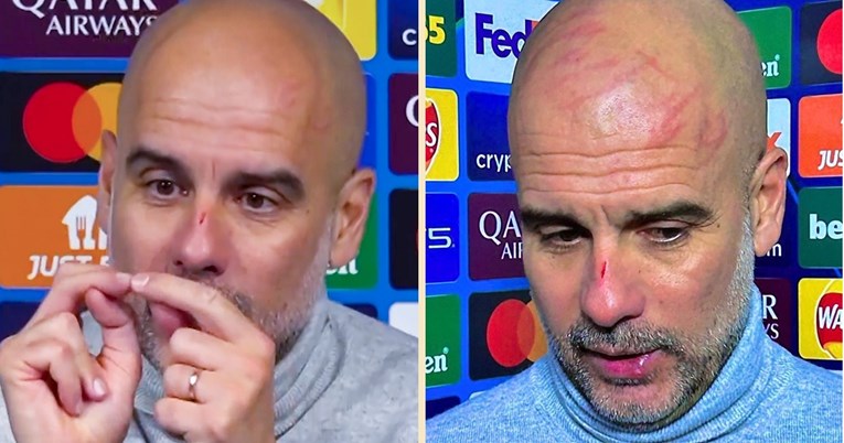 Guardiola došao pred novinare krvavog nosa i pun ožiljaka. Poslušajte objašnjenje