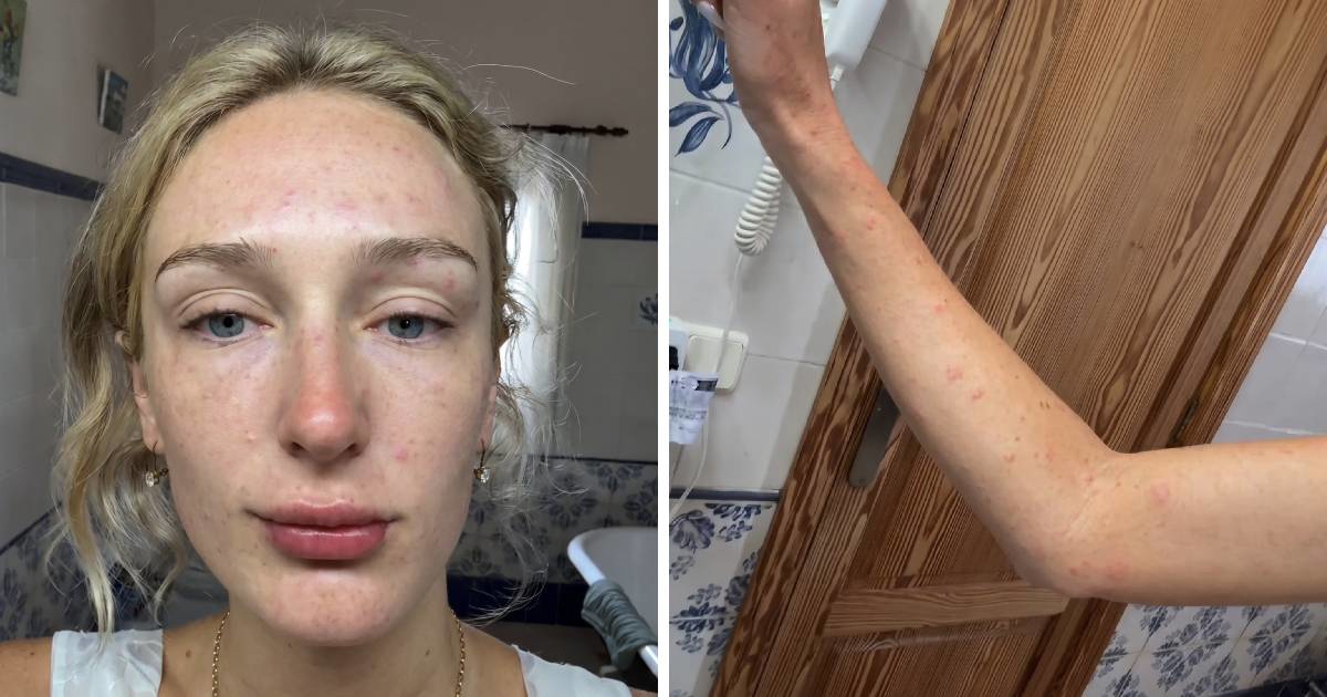 Mladenka otputovala na Mallorcu pa pokazala kako se probudila na dan vjenčanja