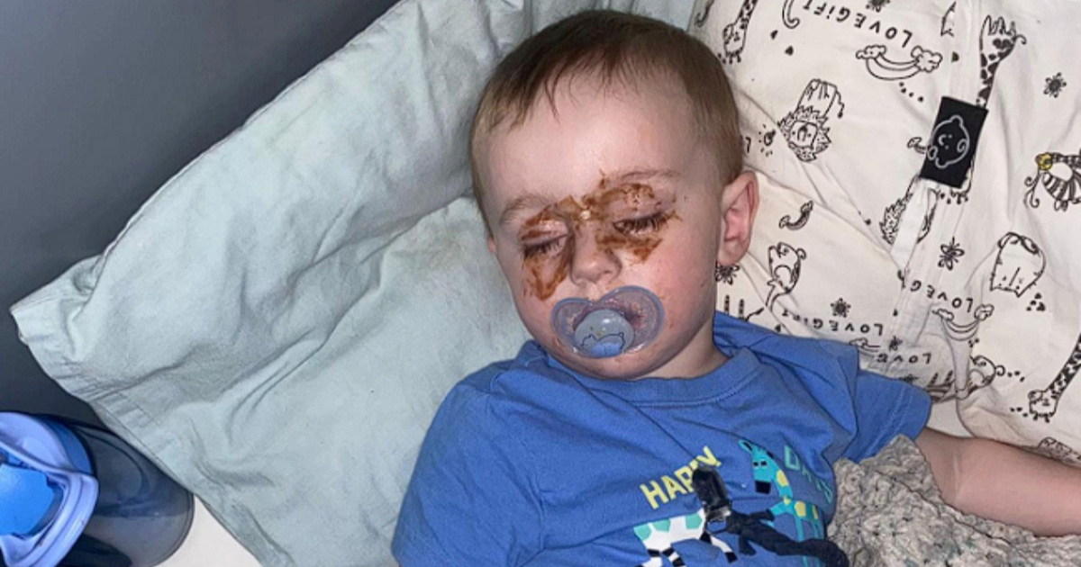 Mama primijetila da sin ima čudne mrlje oko očiju, a onda je shvatila što se dogodilo