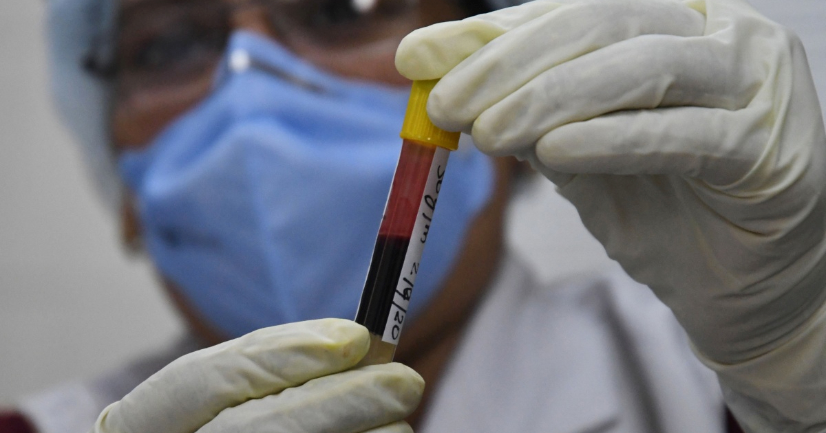 Znanstvenici: Razvili smo prvi krvni test za sindrom kroničnog umora