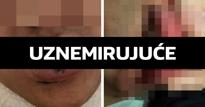 Pretučen u Zagrebu prije tri mjeseca. Policija: Istraga je u tijeku