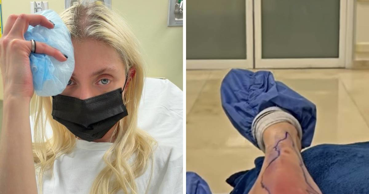 Taylor Momsen hospitalizirana nakon ugriza otrovnog pauka u Meksiku