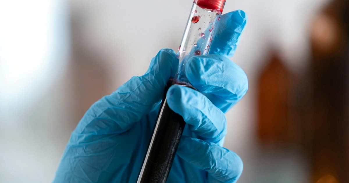 Znanstvenici diljem svijeta pokušavaju replicirati "zlatnu krv"