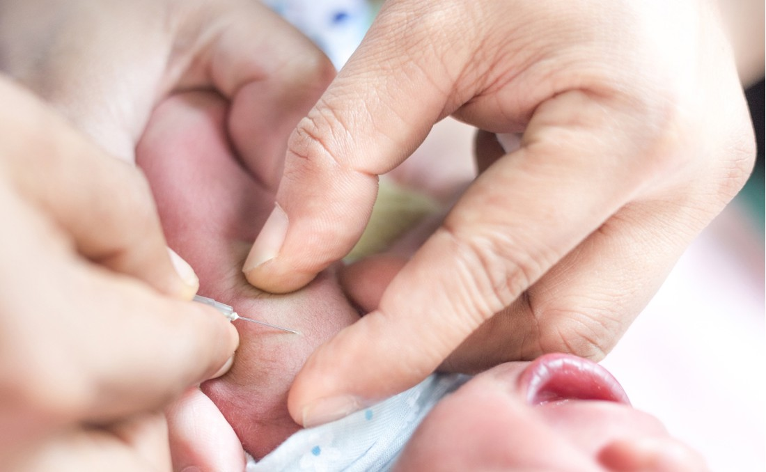 Bebe se protiv tuberkuloze cjepilo bugarskim cjepivom. Zašto baš njime?