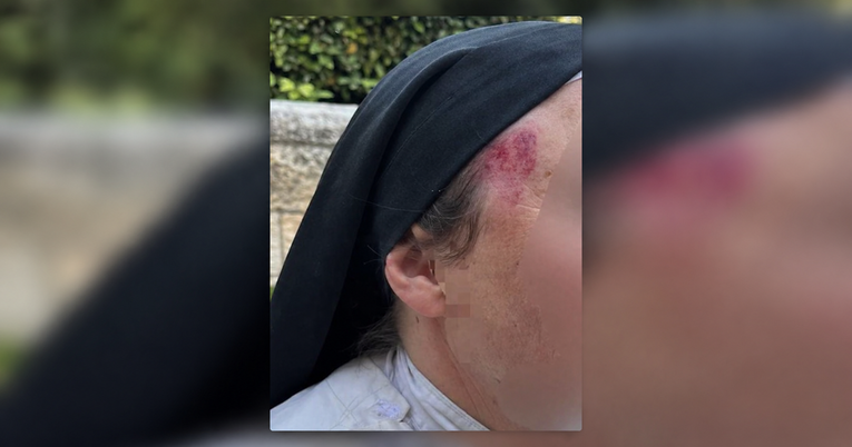 Muškarac u Jeruzalemu srušio francusku časnu sestru pa ju cipelario