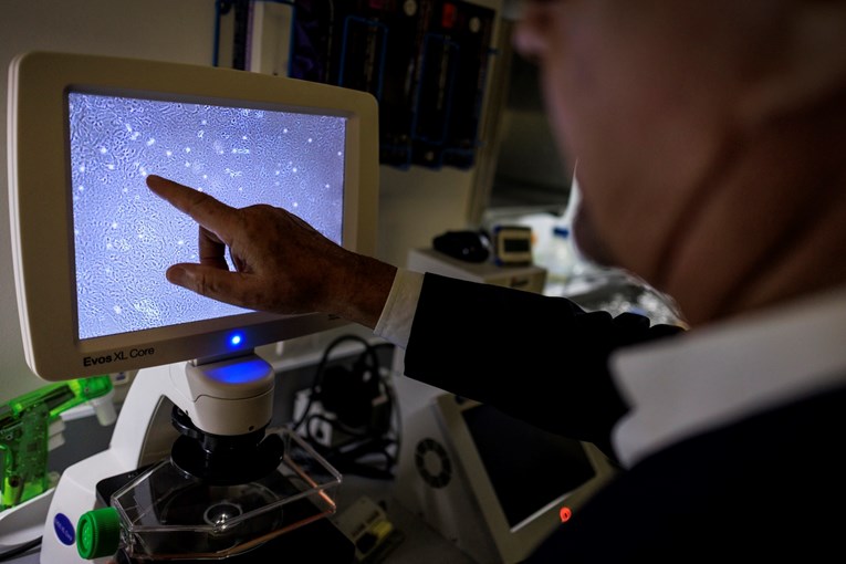 Rak i Alzheimer rijetko se javljaju zajedno. Otkriveno zašto