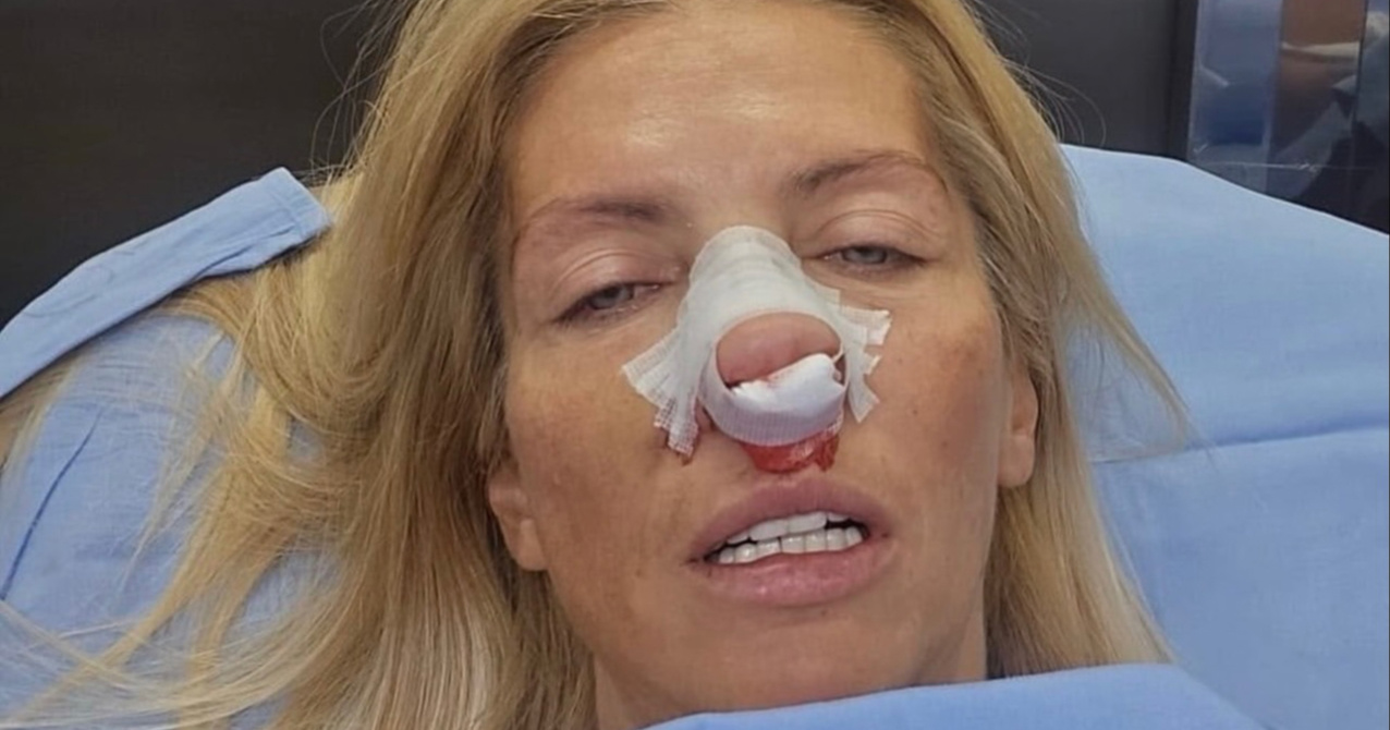FOTO Iz bolnice se javila vijećnica koja tvrdi da ju je udario gradonačelnik Beograda