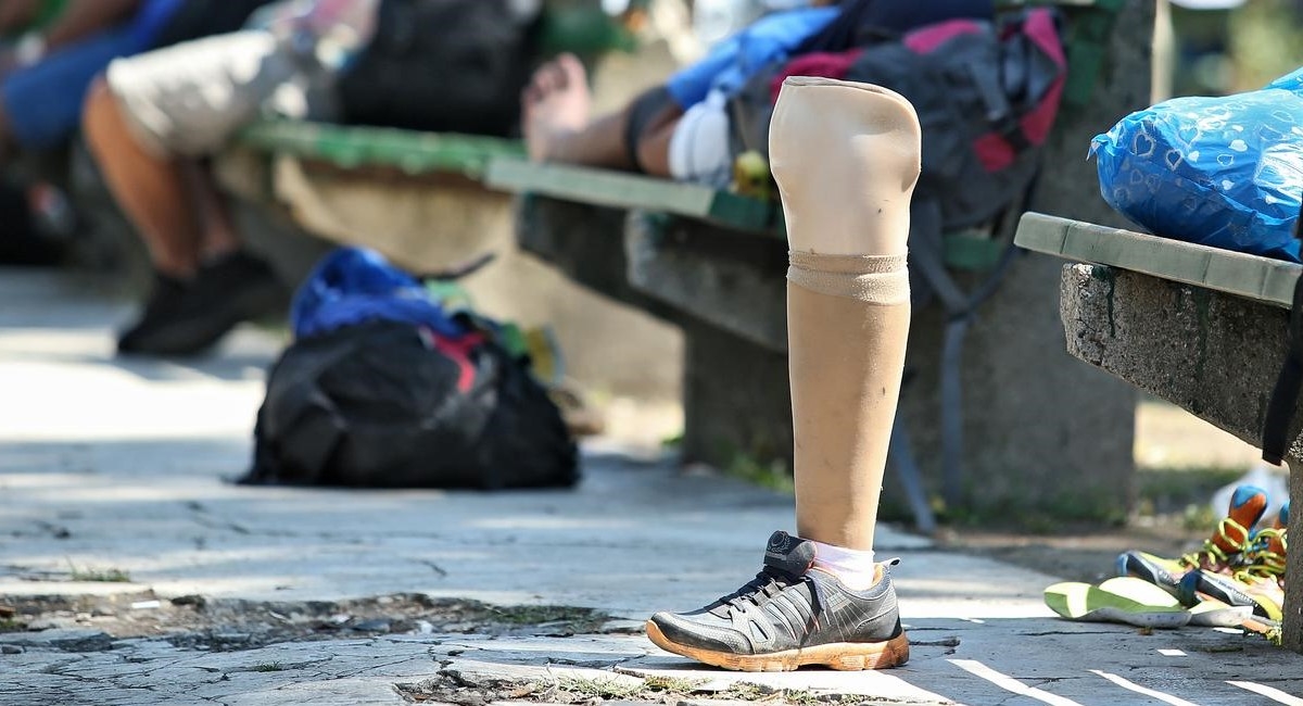 Muškarac iz Banje Luke invalidu ukrao protezu pa je bacio u smeće