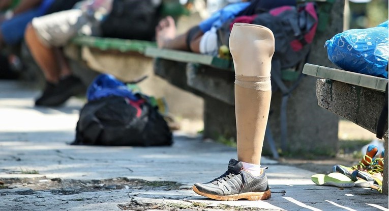 Muškarac iz Banje Luke invalidu ukrao protezu pa je bacio u smeće