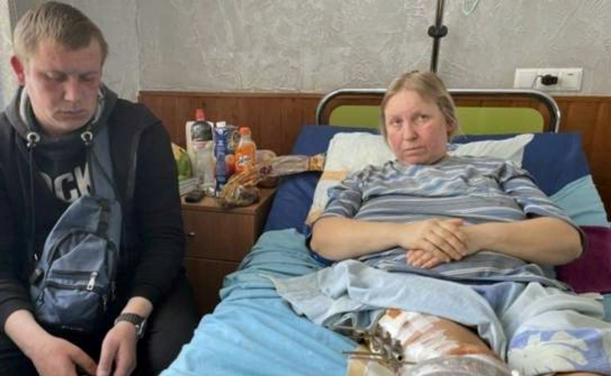 Ukrajinka: Digla sam ruke u zrak, a Rusi su mi pucali u noge