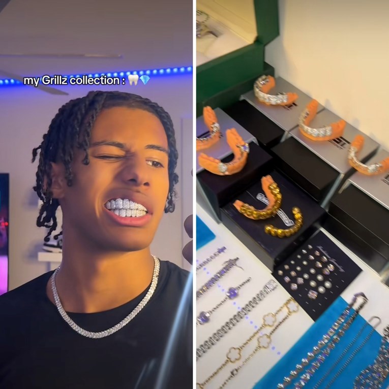 Novi bizarni trend generacije Z zabrinuo stomatologe: Sad je in ukrašavati zube