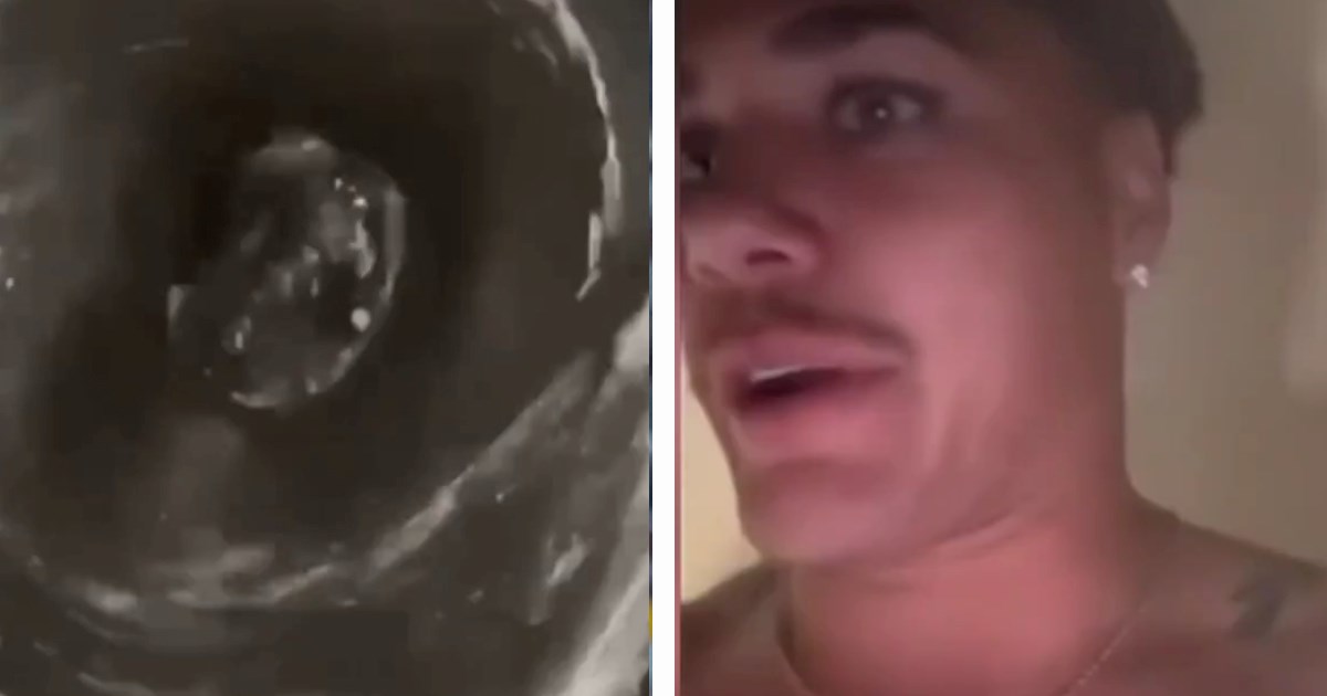 VIDEO Ragbijaš kaže da pije vodu iz WC školjke za oporavak. To je postao opasan trend