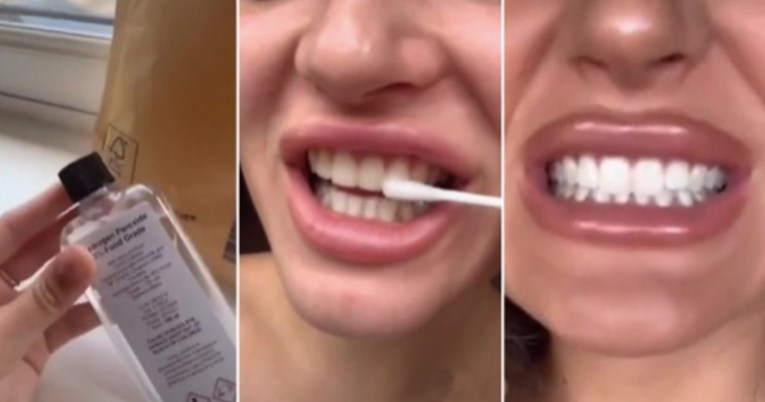 Ljudi izbjeljivačem pokušavaju izbijeliti zube, stručnjaci upozorili da to ne rade