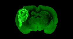Znanstvenici štakoru ugradili minijaturni ljudski mozak. Evo što su otkrili