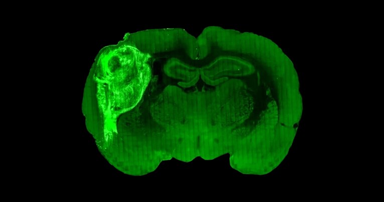 Znanstvenici štakoru ugradili minijaturni ljudski mozak. Evo što su otkrili