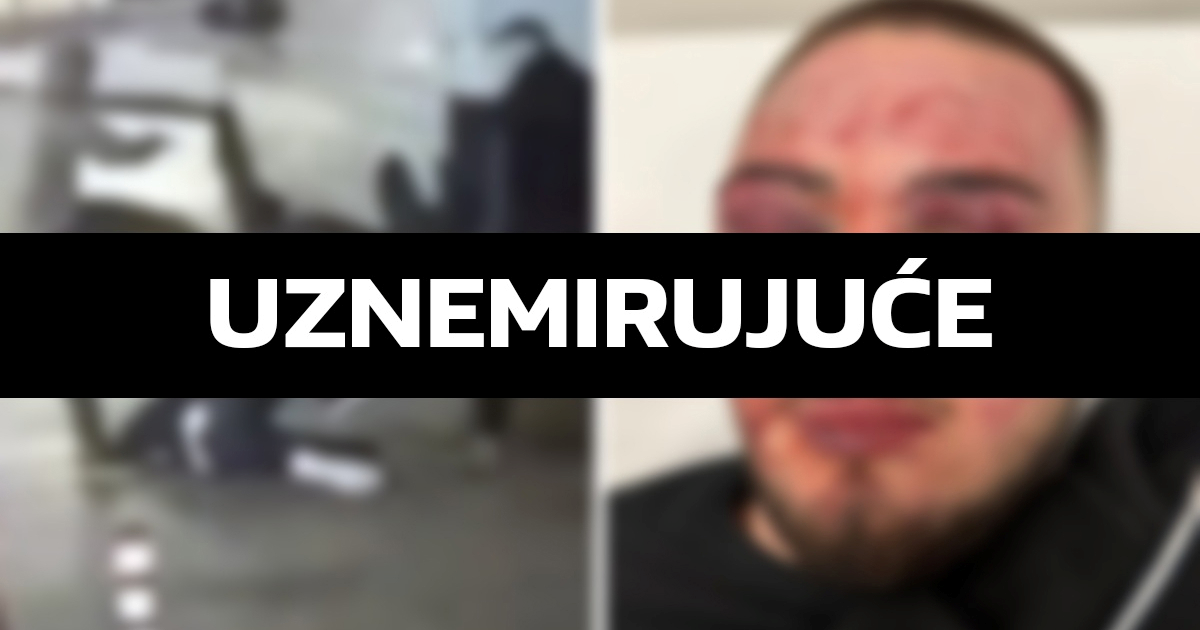 Uhićen i drugi napadač na maloljetnika u Rijeci. Ima 33 godine