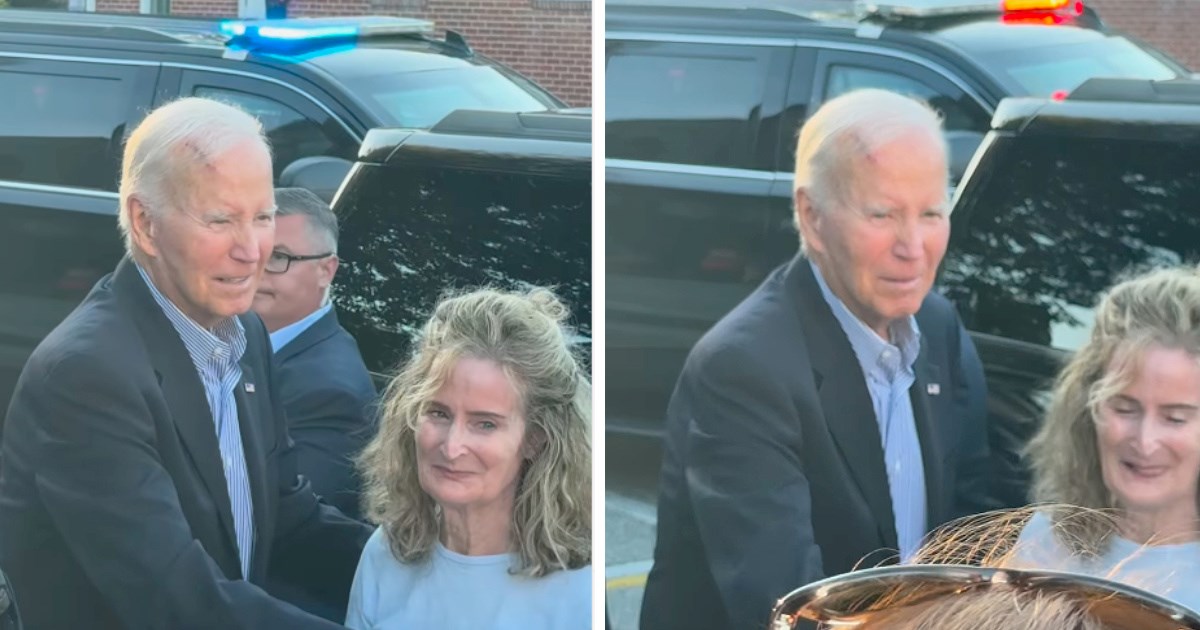 Joe Biden snimljen s ožiljkom na glavi. Operiran je zbog raka kože