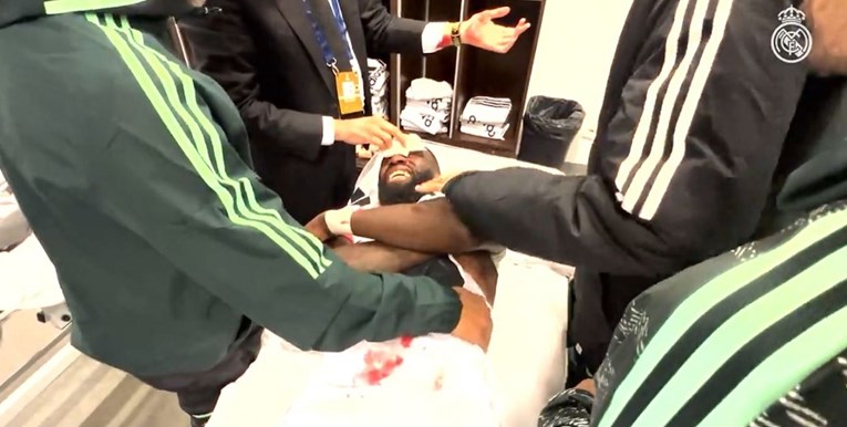 Ancelotti: Jedan nezamjenjivi neće igrati El Clasico, ali tu je ratnik s 20 šavova