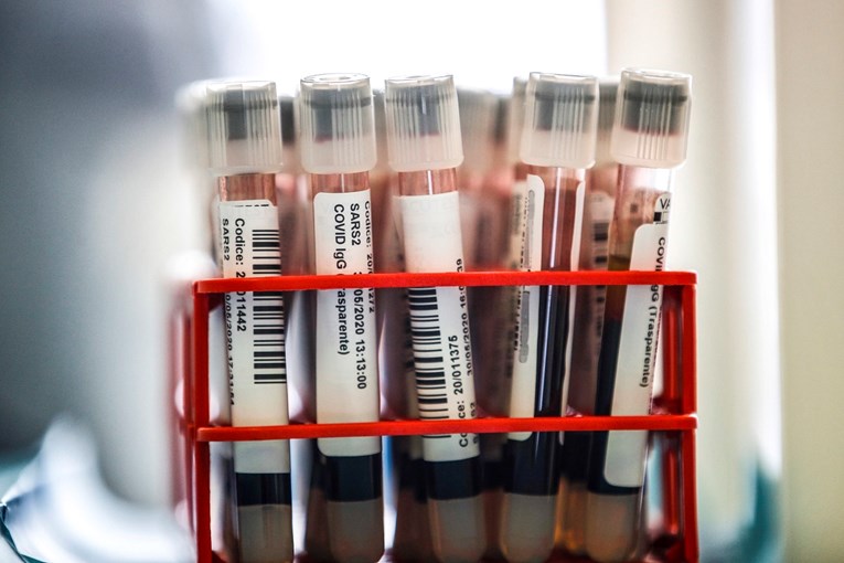 Smanjuje li krvna grupa rizik od zaraze koronavirusom?