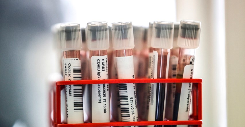 Smanjuje li krvna grupa rizik od zaraze koronavirusom?