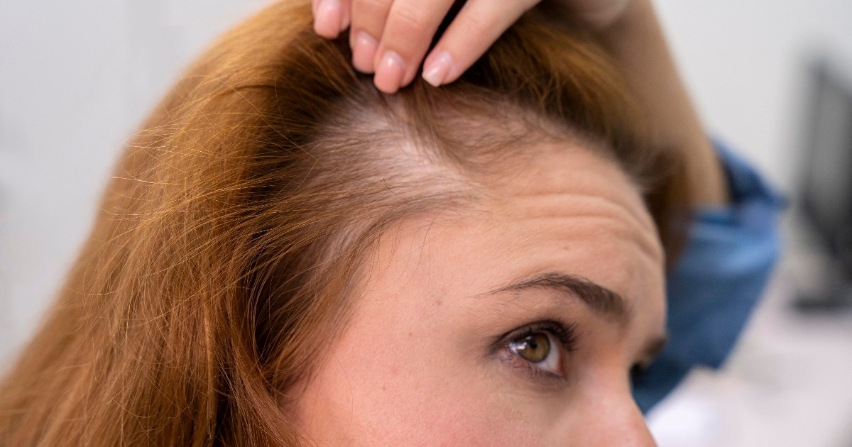 Ne, ne umišljate. Kosa stvarno više opada u ovo doba godine