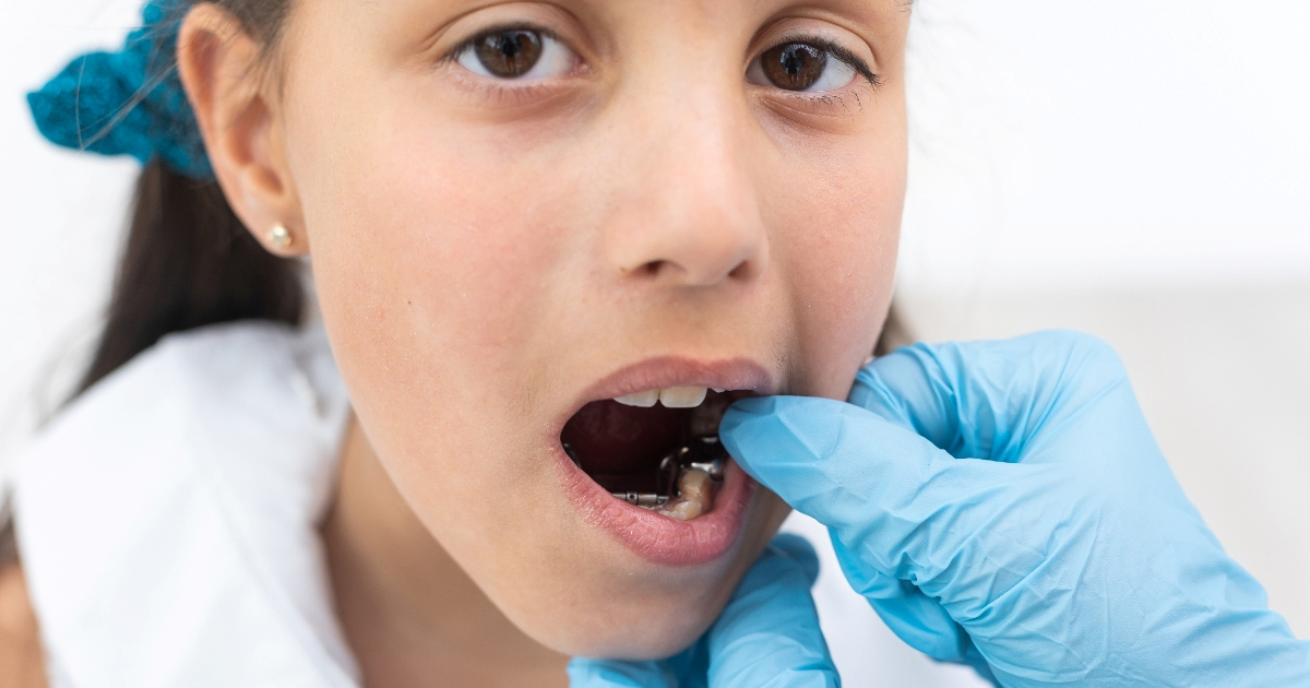 Zaboravite Labubu, ovo je novi &quot;must&#x2011;have&quot; koji djeca nose u ustima