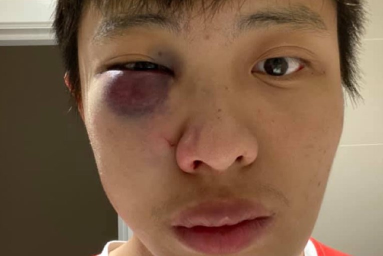 Student iz Azije pretučen u centru Londona: "Ne želimo tvoj koronavirus"