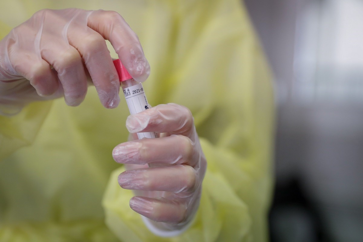 Među 30 novozaraženih u Virovitičko-podravskoj županiji i petero djece