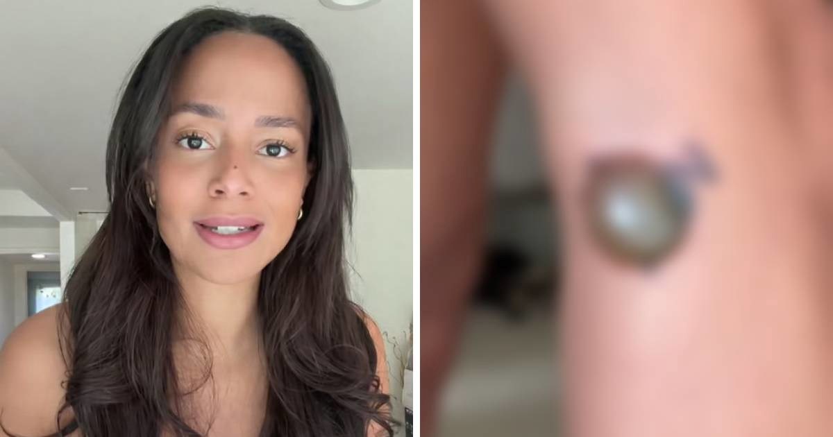 Influencerica u šoku nakon uklanjanja tetovaže, pokazala što joj se pojavilo na nozi