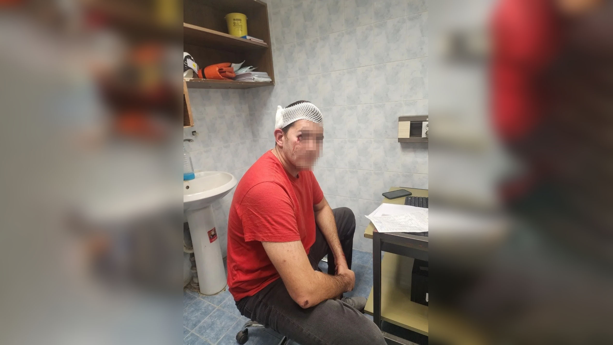 Napadnut promatrač Agencije za sprečavanje korupcije u Beogradu