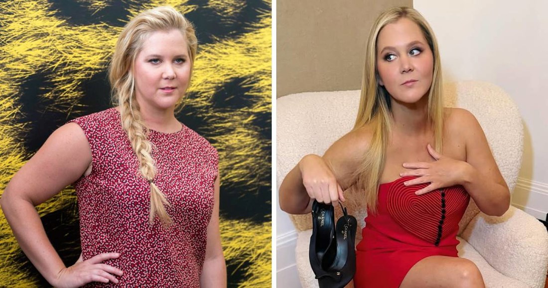 Amy Schumer: Uvijek sam bila ponosna na izgled, nisam izbrisala stare fotke zbog kila