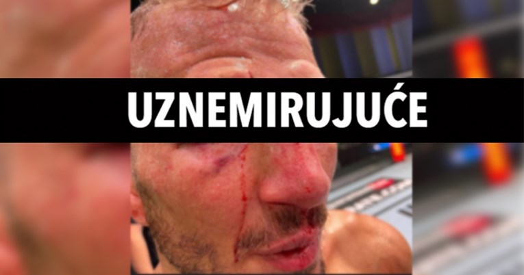 Posjekotina na glavi bivšeg UFC-ovog prvaka dokazuje koliko je MMA brutalan