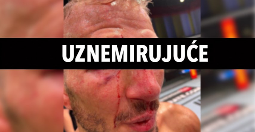 Bivši UFC-ov prvak pokazao brutalnu posjekotinu na glavi nakon borbe