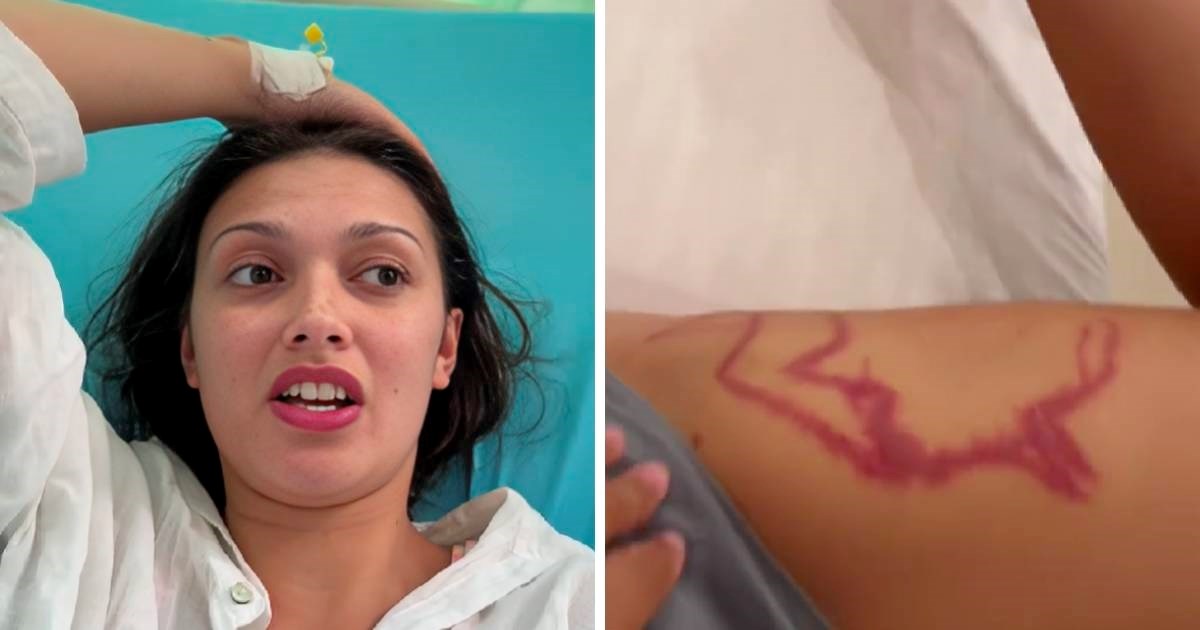 Slučajno snimila trenutak kad ju je ubola jedna od najopasnijih životinja na svijetu