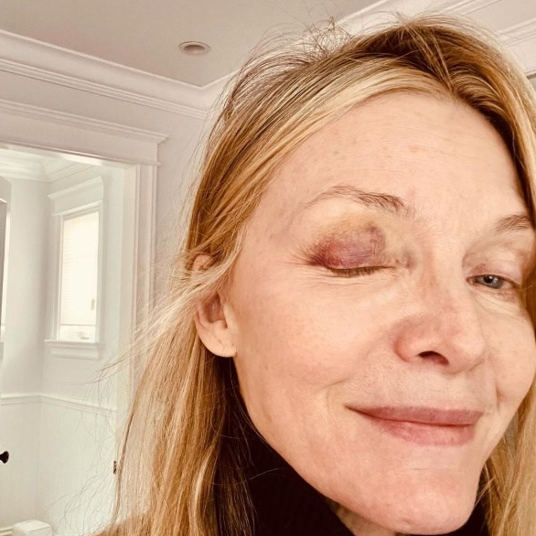 Michelle Pfeiffer pokazala modricu na oku: "Klonite se kuhinje"