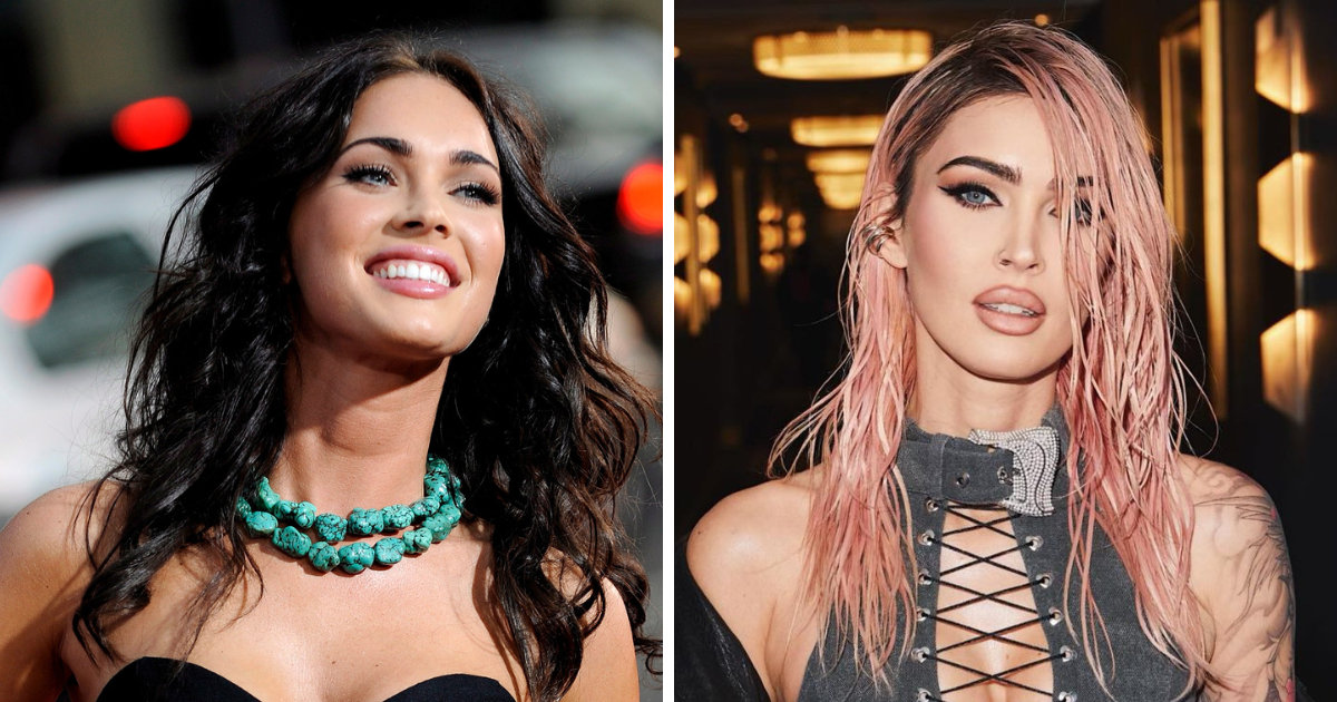 Megan Fox otkrila što je sve operirala