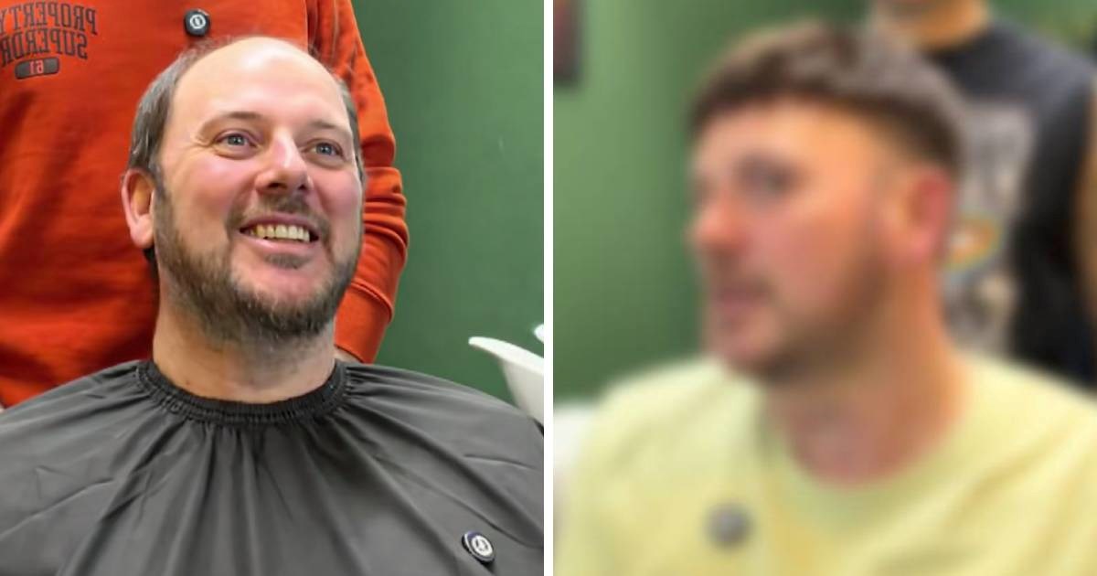 Nakon tretmana umetanja kose pogledao se u ogledalo i zaplakao: "Bio sam ćelav 20 g."