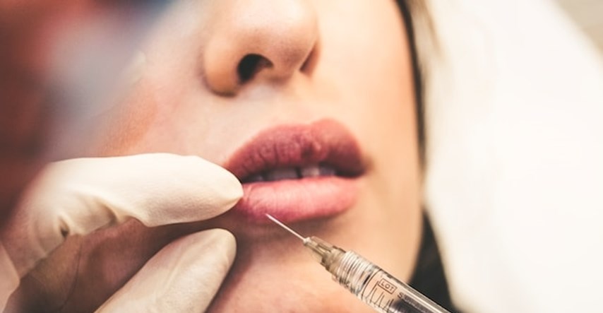 Botox i fileri: Statusni simboli novog doba ili opasna igra s ljepotom?