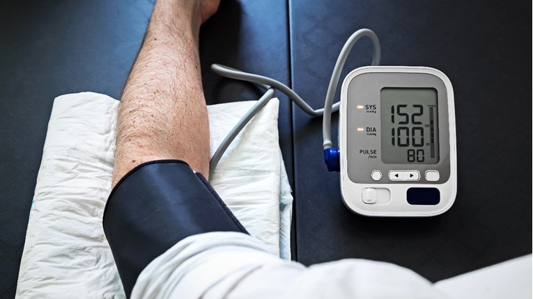 WHO: Pravilno liječenje povišenog krvnog tlaka moglo bi spriječiti 76 milijuna smrti