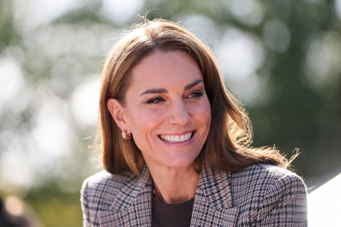 Kate Middleton je nešto popravljala po zubima? Stomatolozi joj analizirali osmijeh