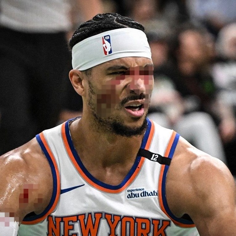 VIDEO Brunson je udario Browna u međunožje. Ubrzo je drugi as Knicksa završio krvav