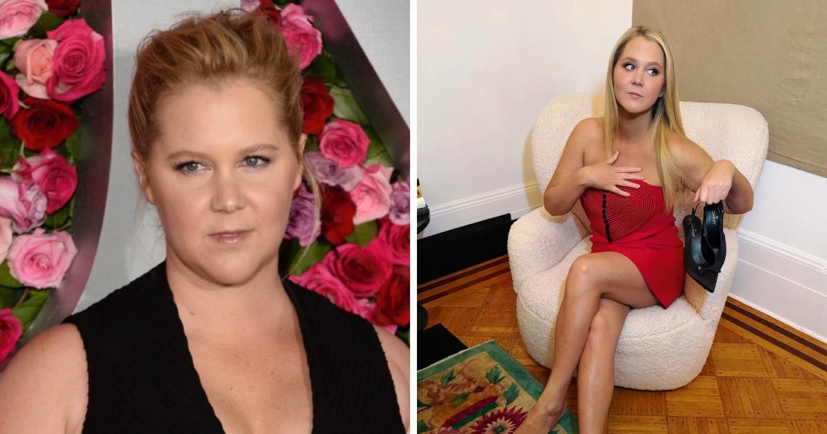 Amy Schumer: Izgubila sam 22 kg da preživim bolest, ne da bih bila zgodna